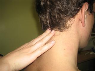 الغدد الليمفاوية على الجزء الخلفي من الرأس